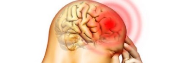 Head (Brain)